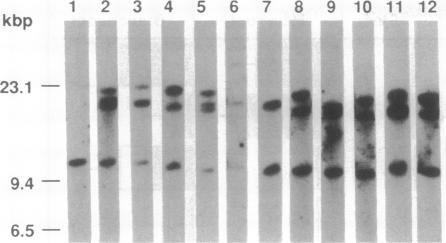 https://cdn.ncbi.nlm.nih.gov/pmc/blobs/a16d/50644/6c4a786ad538/pnas01098-0162-a.jpg