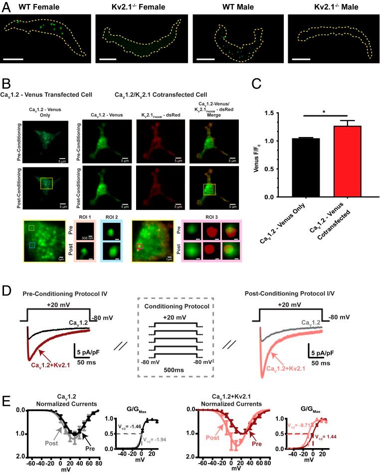 https://cdn.ncbi.nlm.nih.gov/pmc/blobs/a177/7035623/c25230c610c2/pnas.1917879117fig07.jpg