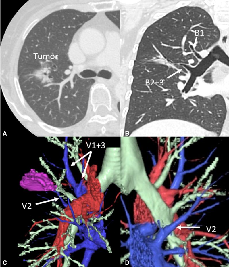 https://cdn.ncbi.nlm.nih.gov/pmc/blobs/a17e/8304485/964dda36fd85/gr1.jpg