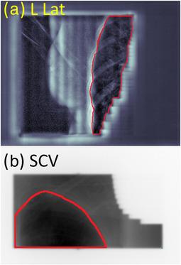 https://cdn.ncbi.nlm.nih.gov/pmc/blobs/a17f/10161105/b6fd4773b242/ACM2-24-e13906-g001.jpg