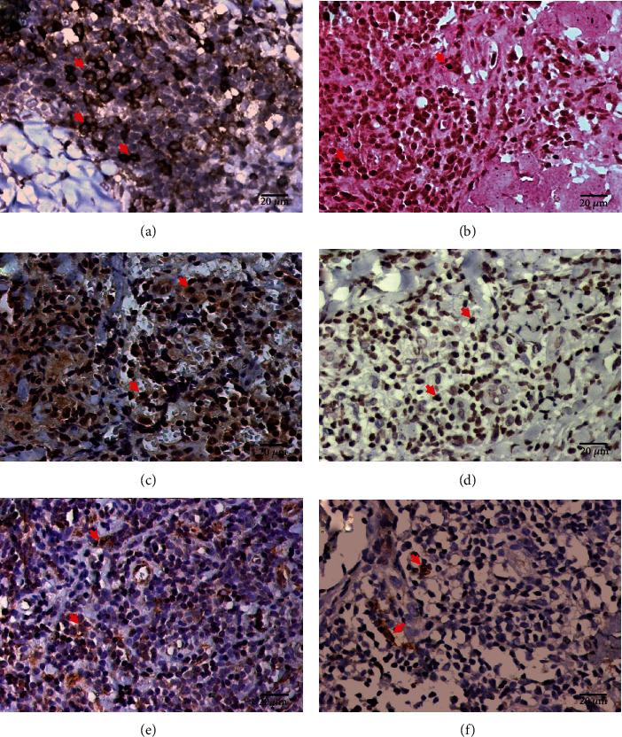https://cdn.ncbi.nlm.nih.gov/pmc/blobs/a188/7641710/124ba4439dcd/MI2020-9278931.001.jpg