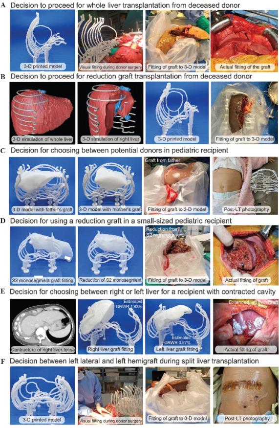 https://cdn.ncbi.nlm.nih.gov/pmc/blobs/a189/9668574/9580aef0247b/IJB-8-4-609-g003.jpg