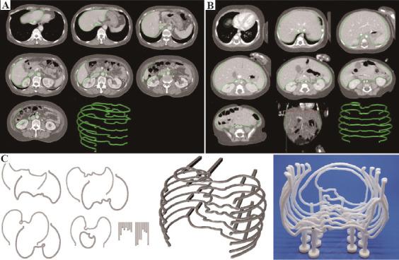 https://cdn.ncbi.nlm.nih.gov/pmc/blobs/a189/9668574/fca845d16ed6/IJB-8-4-609-g001.jpg