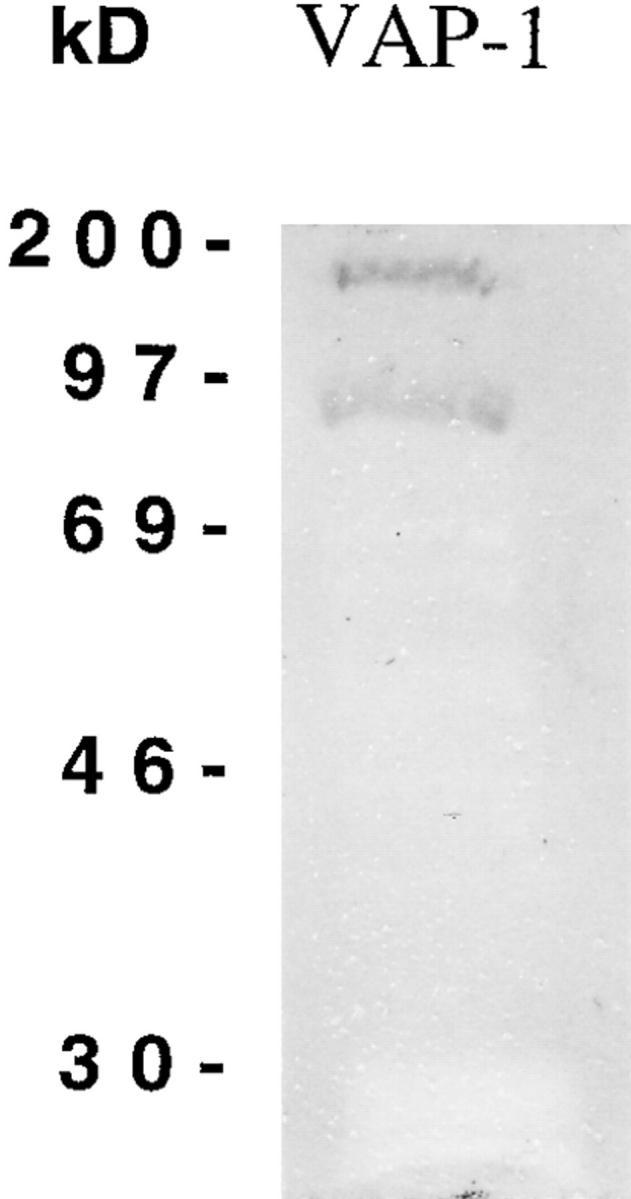 https://cdn.ncbi.nlm.nih.gov/pmc/blobs/a18f/2525535/b89dde7ff9b0/JEM971692.f6.jpg