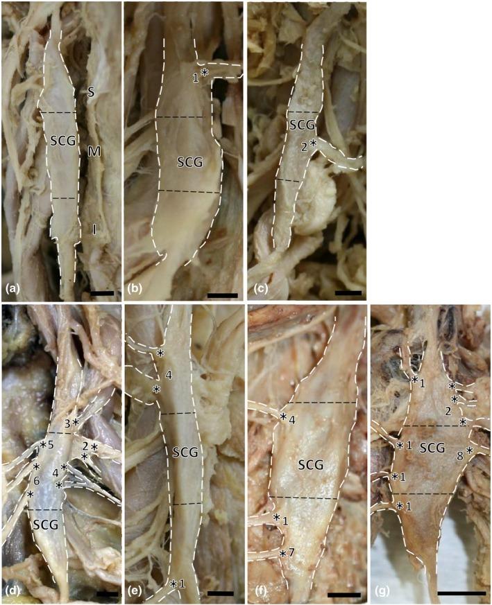 https://cdn.ncbi.nlm.nih.gov/pmc/blobs/a191/5318372/d35bf6727195/BRB3-7-e00619-g002.jpg