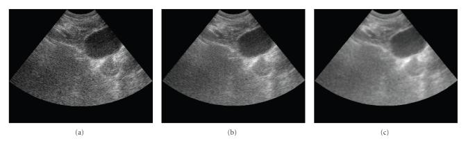 https://cdn.ncbi.nlm.nih.gov/pmc/blobs/a195/2276701/9f7f7c2de512/IJBI2008-274164.005.jpg