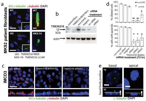 https://cdn.ncbi.nlm.nih.gov/pmc/blobs/a195/2894012/7be5c454c529/ukmss-30246-f0003.jpg