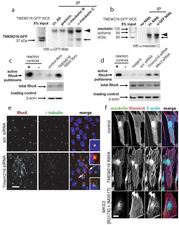 https://cdn.ncbi.nlm.nih.gov/pmc/blobs/a195/2894012/cc607d8be6a4/ukmss-30246-f0004.jpg