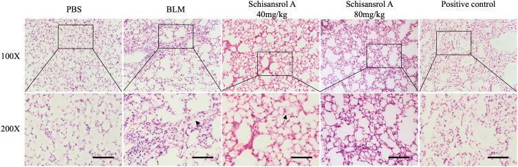 https://cdn.ncbi.nlm.nih.gov/pmc/blobs/a197/9939797/f1a913a1e8b2/DDDT-17-477-g0002.jpg