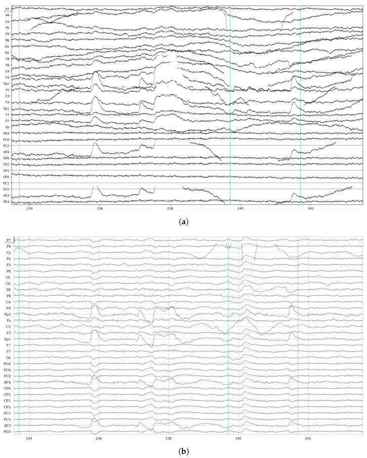 https://cdn.ncbi.nlm.nih.gov/pmc/blobs/a1a0/11359383/228f5e6dc0ea/sensors-24-05207-g001.jpg