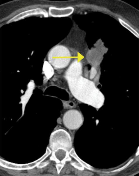 https://cdn.ncbi.nlm.nih.gov/pmc/blobs/a1a1/2072091/21cd6f3ed49a/ci07002607.jpg