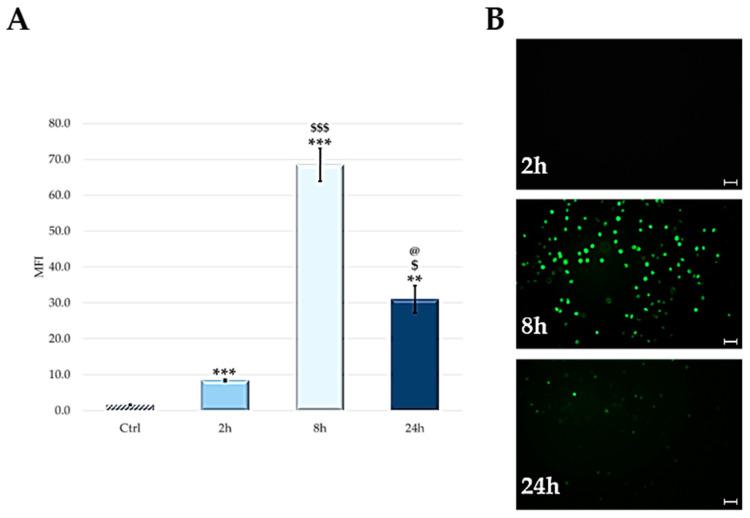 https://cdn.ncbi.nlm.nih.gov/pmc/blobs/a1a1/9966276/7ee1645bcbb1/ijms-24-03131-g007.jpg