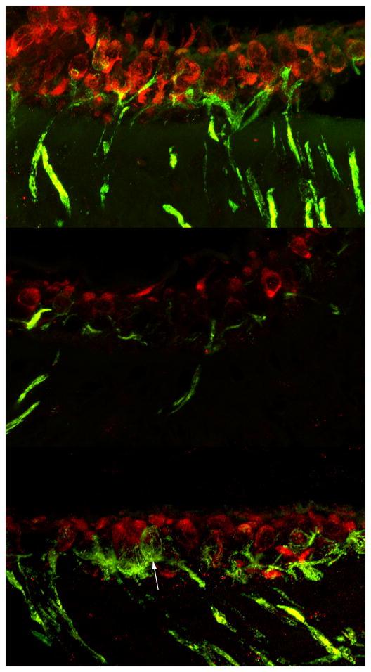 https://cdn.ncbi.nlm.nih.gov/pmc/blobs/a1a2/3136627/81a88bd44429/nihms254293f6.jpg