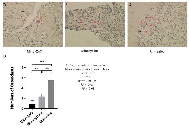 https://cdn.ncbi.nlm.nih.gov/pmc/blobs/a1aa/10499345/1c0558f473ea/medoral-28-e487-g003.jpg