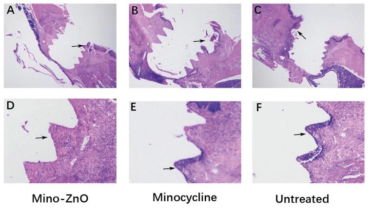 https://cdn.ncbi.nlm.nih.gov/pmc/blobs/a1aa/10499345/2705cd9339f8/medoral-28-e487-g002.jpg