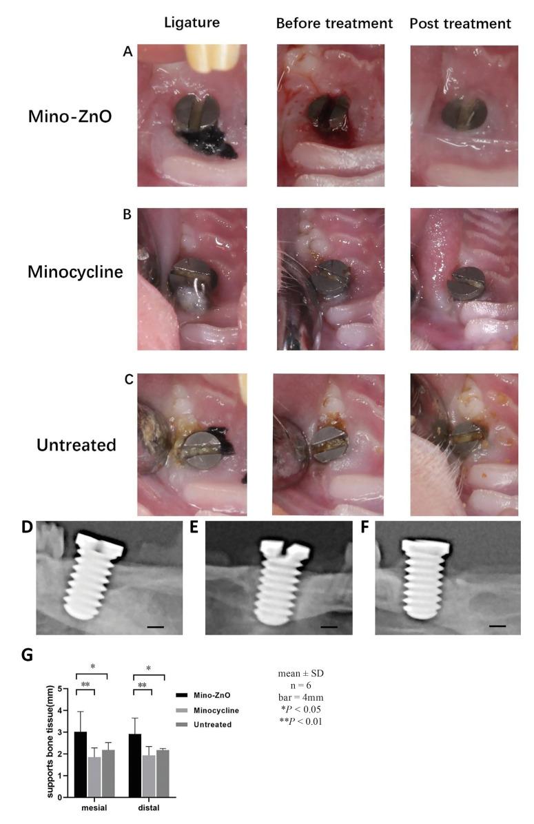 https://cdn.ncbi.nlm.nih.gov/pmc/blobs/a1aa/10499345/76aaeff769ec/medoral-28-e487-g001.jpg