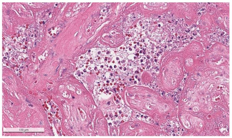 https://cdn.ncbi.nlm.nih.gov/pmc/blobs/a1ab/8950737/7d4209b300ad/viruses-14-00458-g004.jpg
