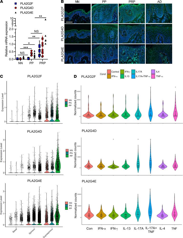 https://cdn.ncbi.nlm.nih.gov/pmc/blobs/a1af/8564909/a04b370e0921/jciinsight-6-151911-g002.jpg