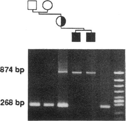 https://cdn.ncbi.nlm.nih.gov/pmc/blobs/a1b1/288178/810782b87c7d/jcinvest00040-0017-a.jpg