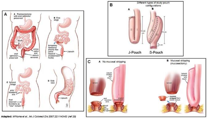 https://cdn.ncbi.nlm.nih.gov/pmc/blobs/a1b5/5734426/405a3d3f50d6/10.1177_1179552217746692-fig1.jpg