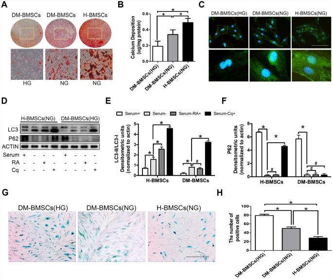https://cdn.ncbi.nlm.nih.gov/pmc/blobs/a1be/7041775/e97e015639c5/aging-12-102723-g001.jpg