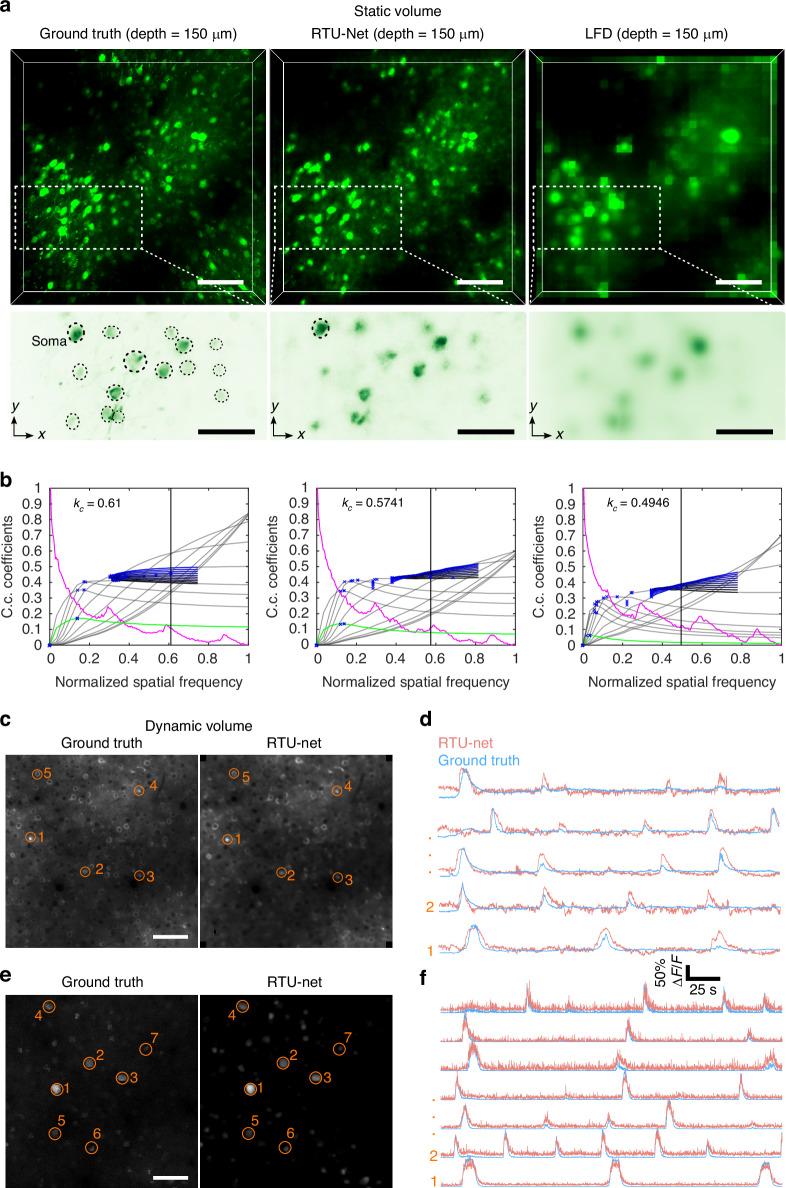 https://cdn.ncbi.nlm.nih.gov/pmc/blobs/a1c3/12041240/d27684a08611/41377_2025_1842_Fig4_HTML.jpg