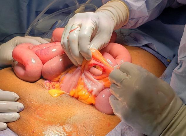 https://cdn.ncbi.nlm.nih.gov/pmc/blobs/a1c3/6324651/c637edbea938/rjy342f06.jpg