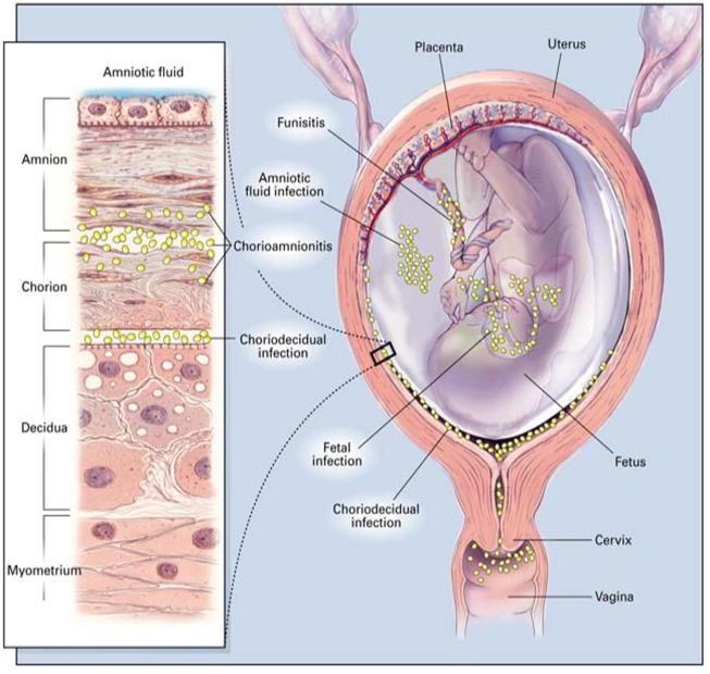 https://cdn.ncbi.nlm.nih.gov/pmc/blobs/a1c7/6891229/2a4fef08d33f/gr1.jpg