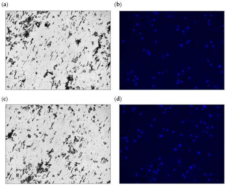 https://cdn.ncbi.nlm.nih.gov/pmc/blobs/a1ce/11436177/42dfe92d9d87/sensors-24-06031-g010.jpg