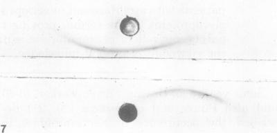 https://cdn.ncbi.nlm.nih.gov/pmc/blobs/a1d6/414804/59a10572857b/iai00242-0126-f.jpg