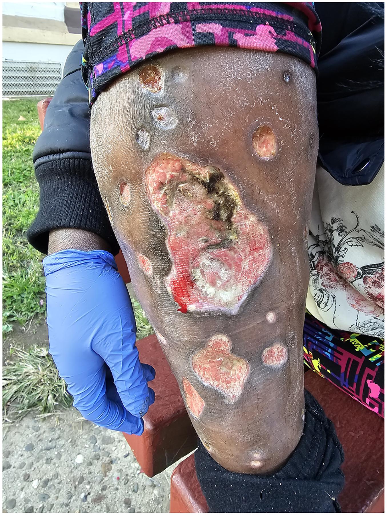 https://cdn.ncbi.nlm.nih.gov/pmc/blobs/a1d7/12167673/d6005427576c/nihms-2082429-f0002.jpg