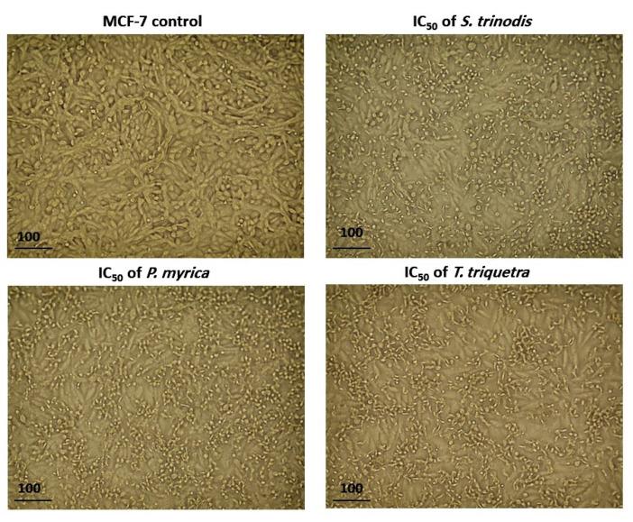 https://cdn.ncbi.nlm.nih.gov/pmc/blobs/a1d9/10381385/ba3f9075e611/marinedrugs-21-00404-g005.jpg