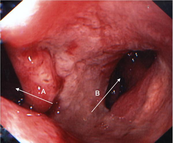 https://cdn.ncbi.nlm.nih.gov/pmc/blobs/a1df/2997099/9a89375cd49c/1752-1947-4-376-1.jpg