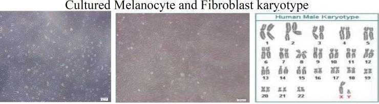 https://cdn.ncbi.nlm.nih.gov/pmc/blobs/a1e5/9840759/1a44489126ab/wjps-11-116-g002.jpg