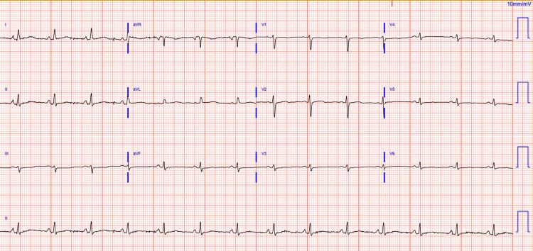 https://cdn.ncbi.nlm.nih.gov/pmc/blobs/a1e9/12398392/a301592d0505/cureus-0017-00000089152-i01.jpg