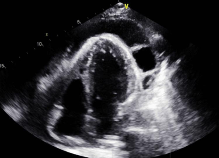 https://cdn.ncbi.nlm.nih.gov/pmc/blobs/a1e9/12398392/b5adcdc96cbc/cureus-0017-00000089152-i02.jpg