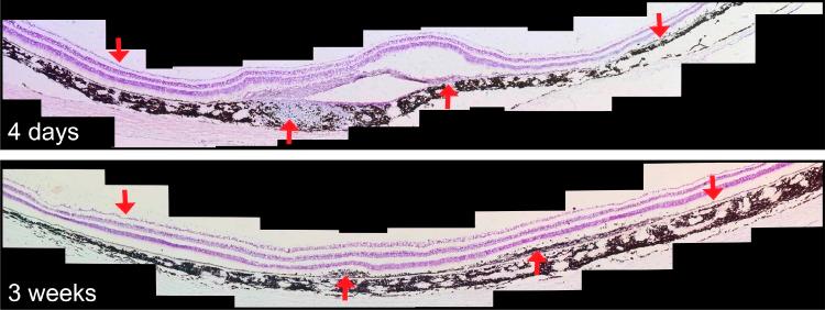 https://cdn.ncbi.nlm.nih.gov/pmc/blobs/a1e9/5846443/39fa5fe90233/i1552-5783-59-3-1374-f05.jpg