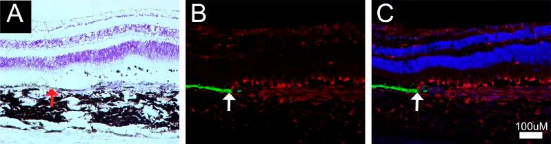 https://cdn.ncbi.nlm.nih.gov/pmc/blobs/a1e9/5846443/ddab35ff3c2a/i1552-5783-59-3-1374-f06.jpg