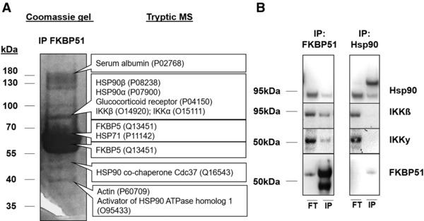 https://cdn.ncbi.nlm.nih.gov/pmc/blobs/a1e9/6282724/b0819c55e323/EJI-48-1904-g004.jpg