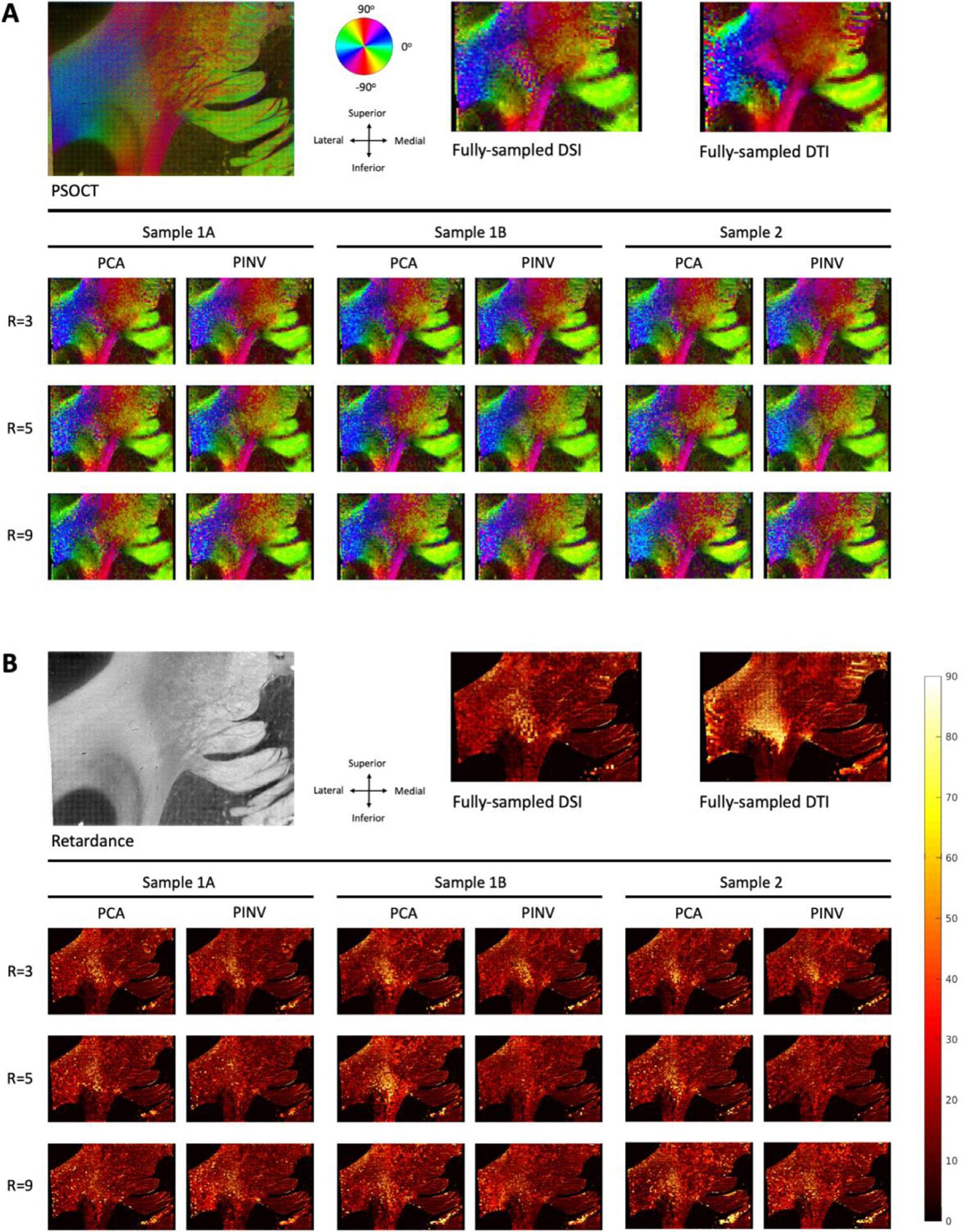 https://cdn.ncbi.nlm.nih.gov/pmc/blobs/a1f7/8631240/f2c48752dfa1/nihms-1757346-f0003.jpg