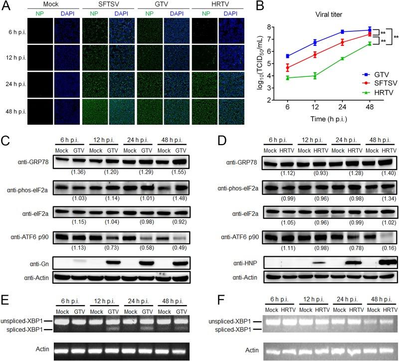 https://cdn.ncbi.nlm.nih.gov/pmc/blobs/a1f8/6498065/ffff2ca14d55/JVI.00308-19-f0007.jpg