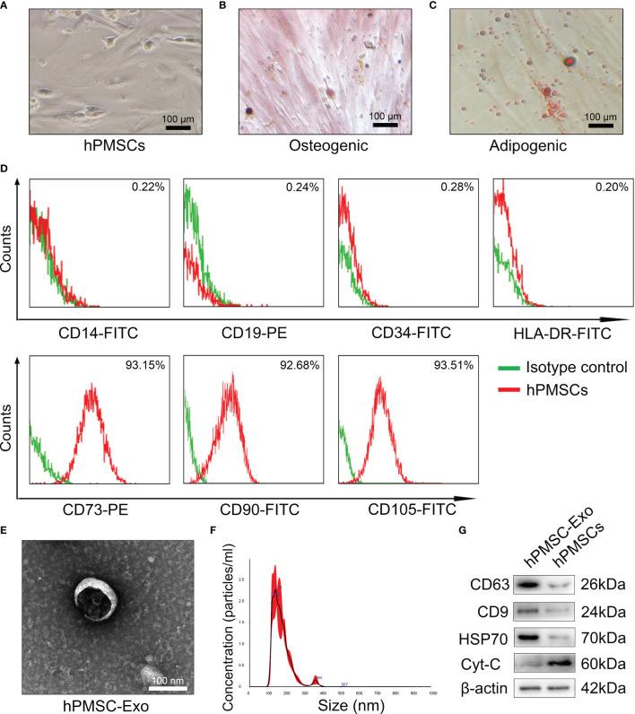 https://cdn.ncbi.nlm.nih.gov/pmc/blobs/a20a/8649962/e80bd93e587b/fimmu-12-780897-g001.jpg