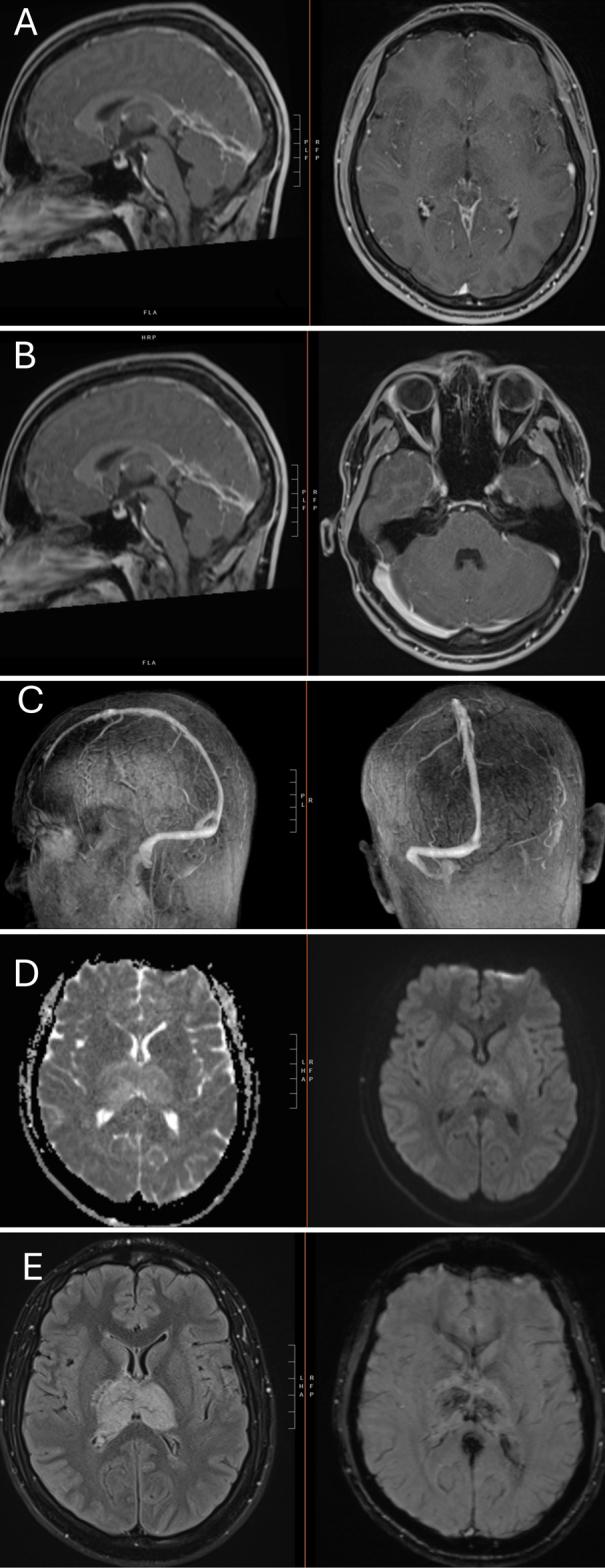 https://cdn.ncbi.nlm.nih.gov/pmc/blobs/a216/12147660/5645d9858094/CASE25192_figure_2.jpg