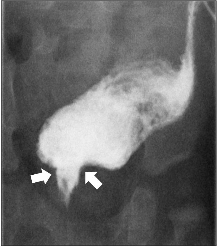https://cdn.ncbi.nlm.nih.gov/pmc/blobs/a219/4717608/4551762d6216/astr-90-49-g004.jpg