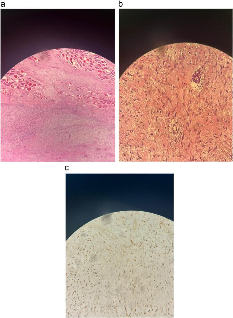 https://cdn.ncbi.nlm.nih.gov/pmc/blobs/a21c/12019195/0340cfd9bed8/gr4.jpg