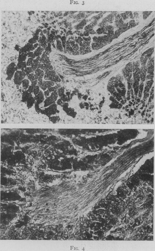 https://cdn.ncbi.nlm.nih.gov/pmc/blobs/a220/1803367/004601f15e35/annsurg01366-0090-a.jpg