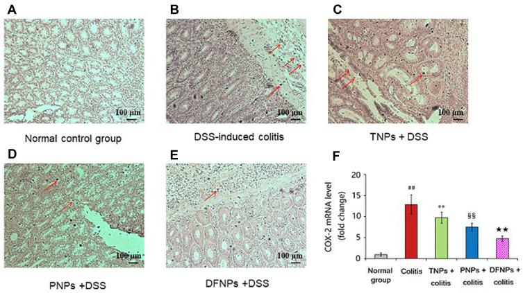 https://cdn.ncbi.nlm.nih.gov/pmc/blobs/a222/7917316/725020df550f/IJN-16-1405-g0011.jpg