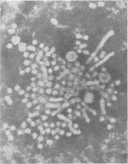 https://cdn.ncbi.nlm.nih.gov/pmc/blobs/a229/1347245/1e56e09590ce/jclinpath00437-0029-b.jpg