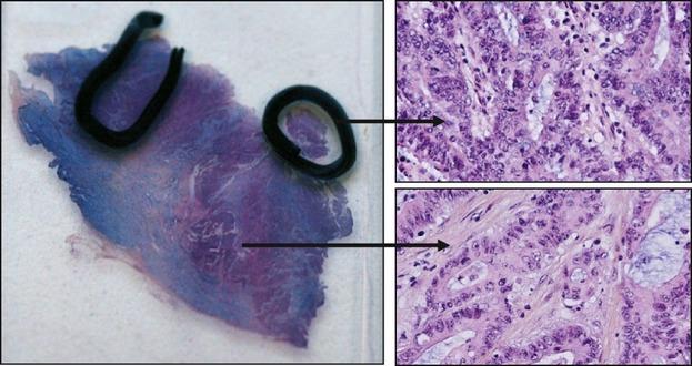 https://cdn.ncbi.nlm.nih.gov/pmc/blobs/a22b/3797557/69ea9d0acad9/cam0002-0011-f1.jpg