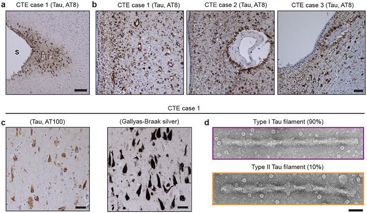 https://cdn.ncbi.nlm.nih.gov/pmc/blobs/a22f/6472968/6126534cb2e2/nihms-1522205-f0001.jpg